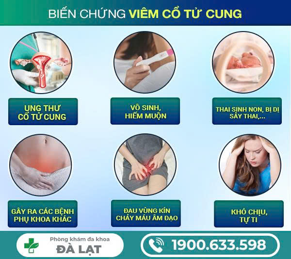 Hình ảnh minh họa